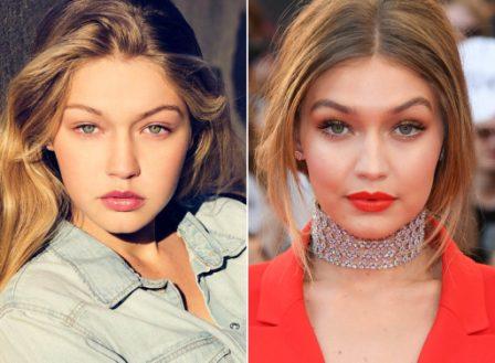 gigi hadid before and after plastic surgery