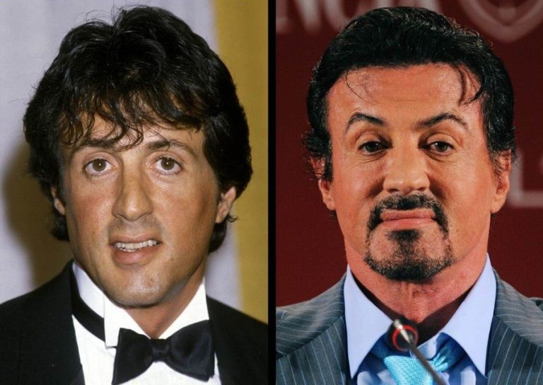Everything There Is To Know About Sylvester Stallone’s Plastic Surgery